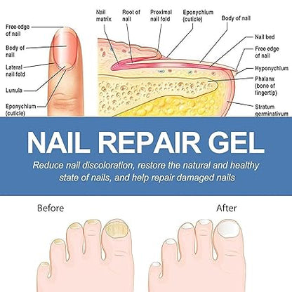 REGENERADOR PRO - TRATAMIENTO PARA LOS HONGOS DE LAS UÑAS EN GEL