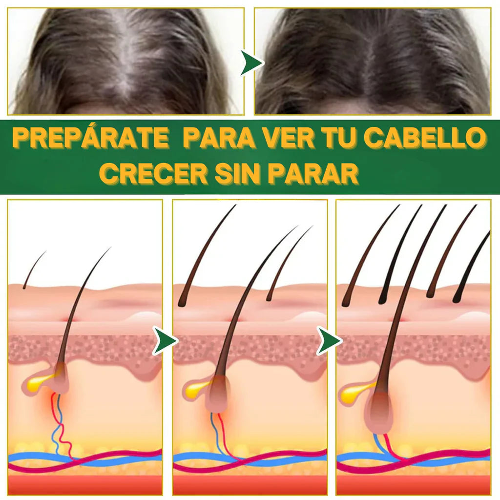 OUHOE CRECIMIENTO Y CONTROL DE CAIDA PARA EL CABELLO