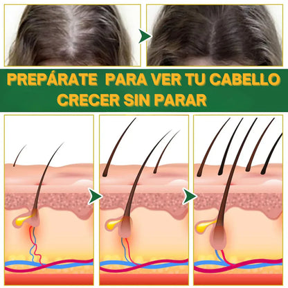 OUHOE CRECIMIENTO Y CONTROL DE CAIDA PARA EL CABELLO